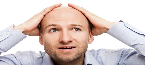 התקרחות גברית